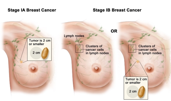55.jpg 3794fc2d-e218-4605-a501-65a707fc1976.png.jpg