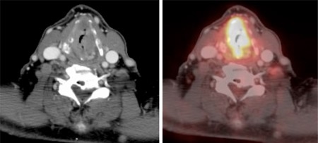 2.jpg 9936155d-8820-43f5-bd9c-34c4e6b57f30.png.jpg