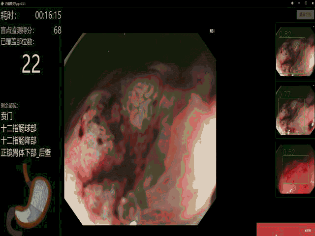 a547c60b-0d1c-47fb-bba4-828d1dca46cb.png.jpg