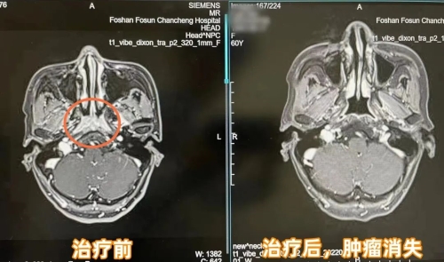 b98cf790-2808-493d-8603-8e1c2a34f0df.png.jpg