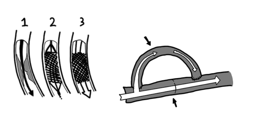 e317a75c-6e59-40e3-8037-8ff02a566993.png.png