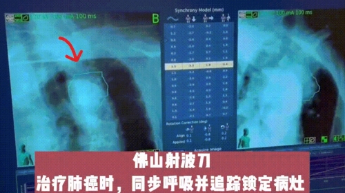 f67784df-60a2-4984-83f4-2448e18ff7bf.png.jpg