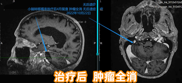 6666.png 3c283f3d-c541-4fd4-bae1-d03c5ea8d571.png.png