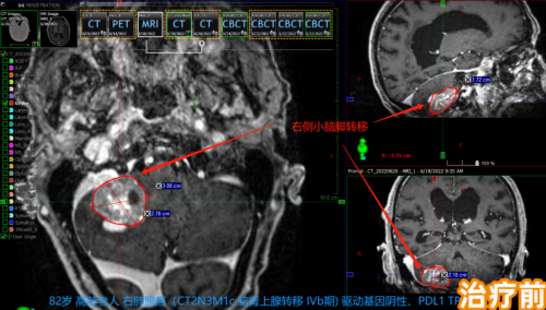 5555.png 73e7ed93-879e-43e3-8e2c-3109ed7e6b68.png.png