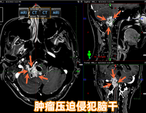 7777.png dbda8f95-f853-48b2-87f8-756563447c97.png.png