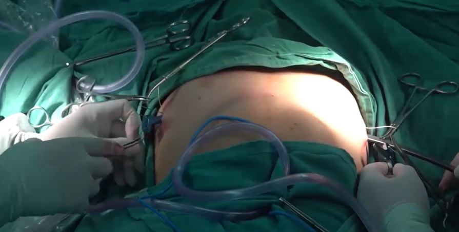 图片3.png 图片3.png