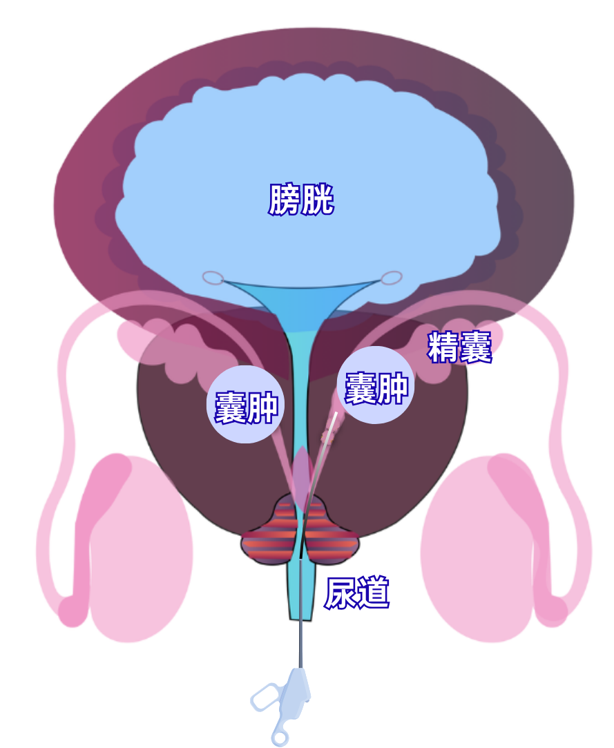 30317497-6f5b-45bb-b7a9-ae51221b6234.png.png