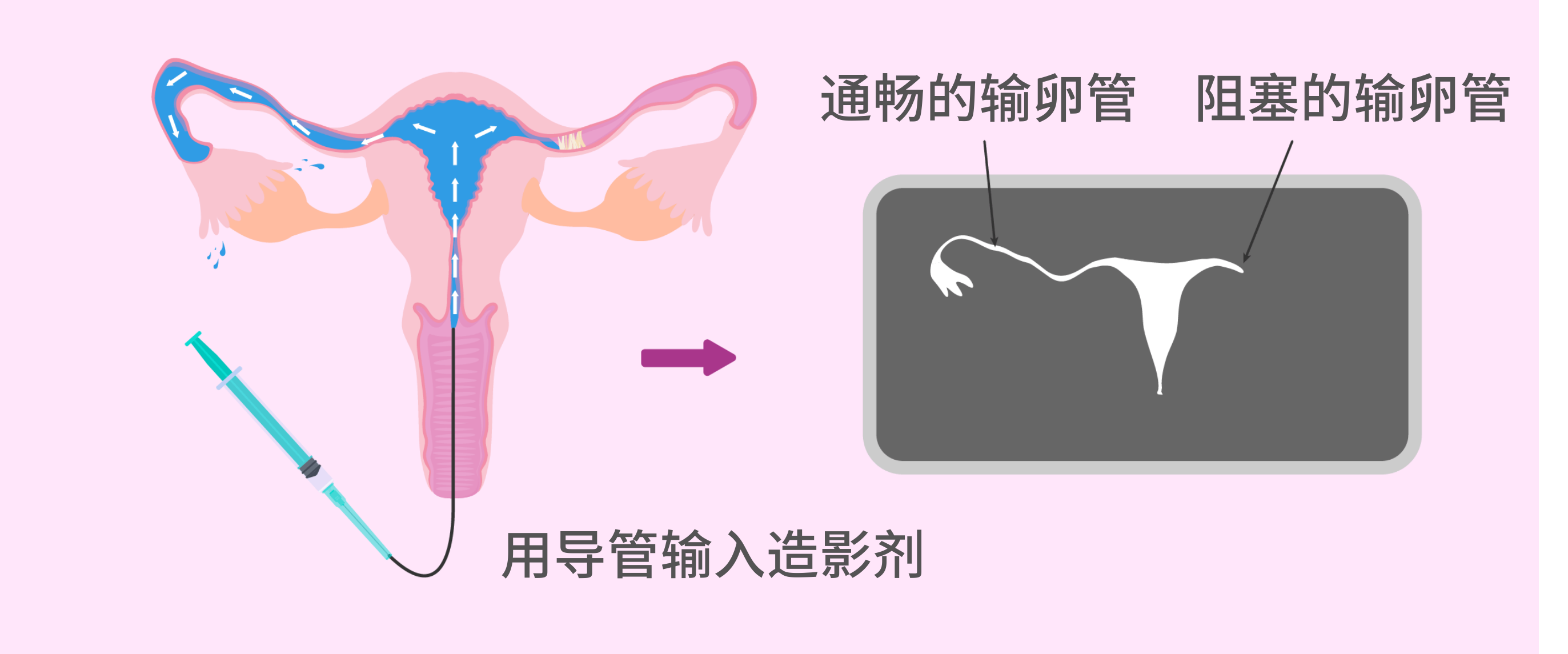 3ad9b841-2a9c-4cec-90ff-929bdf4cba80.png.png