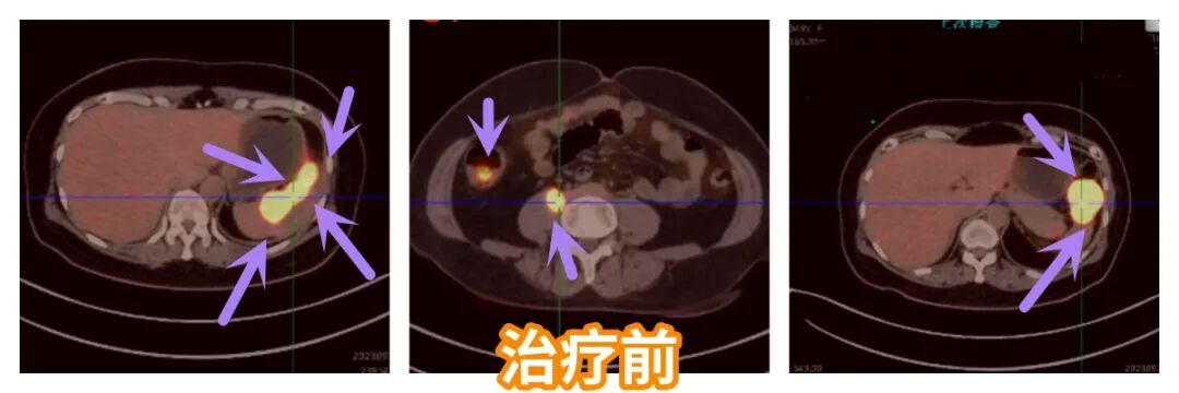 70fd4d89-36aa-41fc-b52f-0059f4fb637d.png.jpg