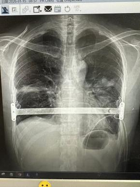 图片16.png 840adfe1-b2d8-4ac5-8016-7f55f38701fa.png.png