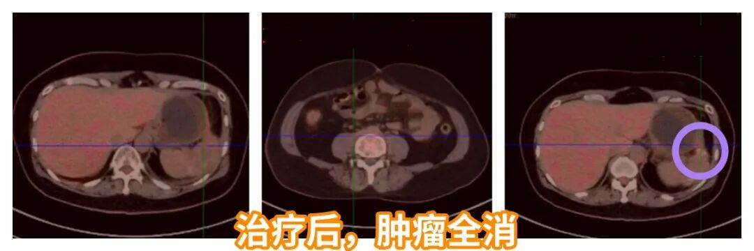 acf32297-6895-45dc-8cc7-a5f2122da5e6.png.jpg