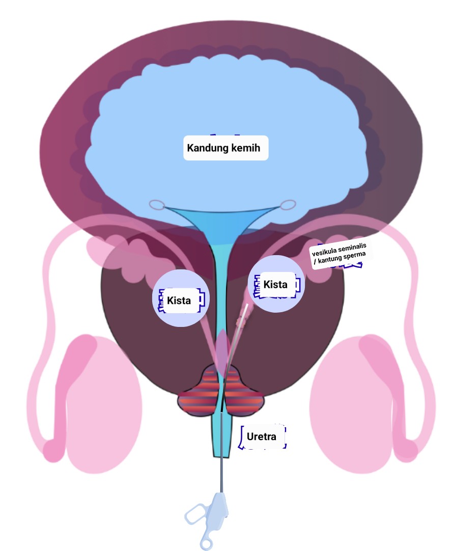 1186839d-badd-4536-a2d5-12910f61cf6f.png.jpg