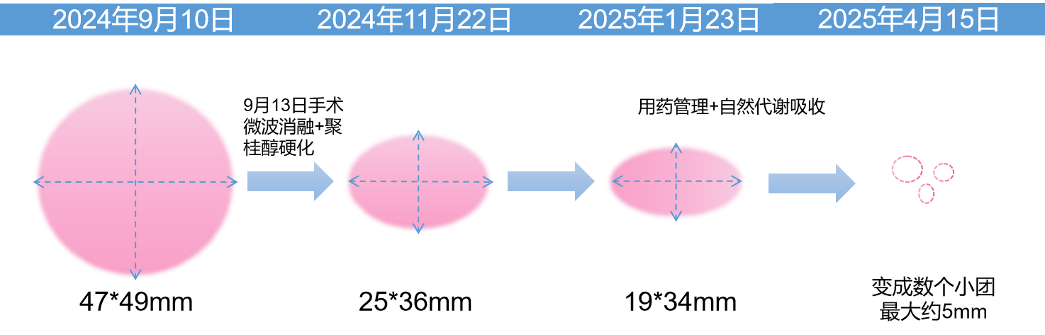 ecc906a8-36d5-499b-ada4-2ee23cfeb1cf.png.png
