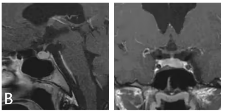 033e39de-ce92-4ed9-b00d-8d100c8c5bd1.png.png