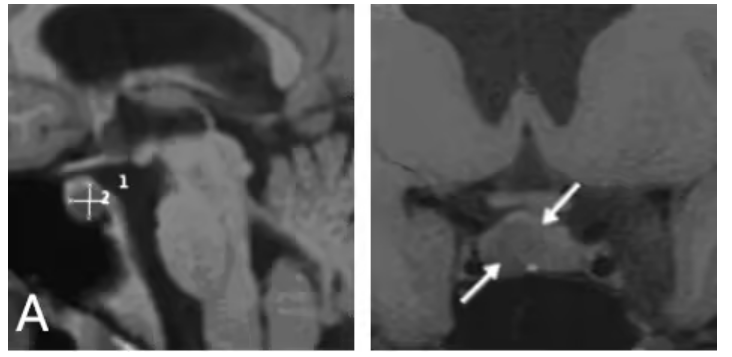 beaec016-5e47-4284-8329-8978c2343a69.png.png