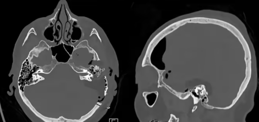 image.png c963bca9-565f-457c-b41b-d2d91a4f213e.png.png